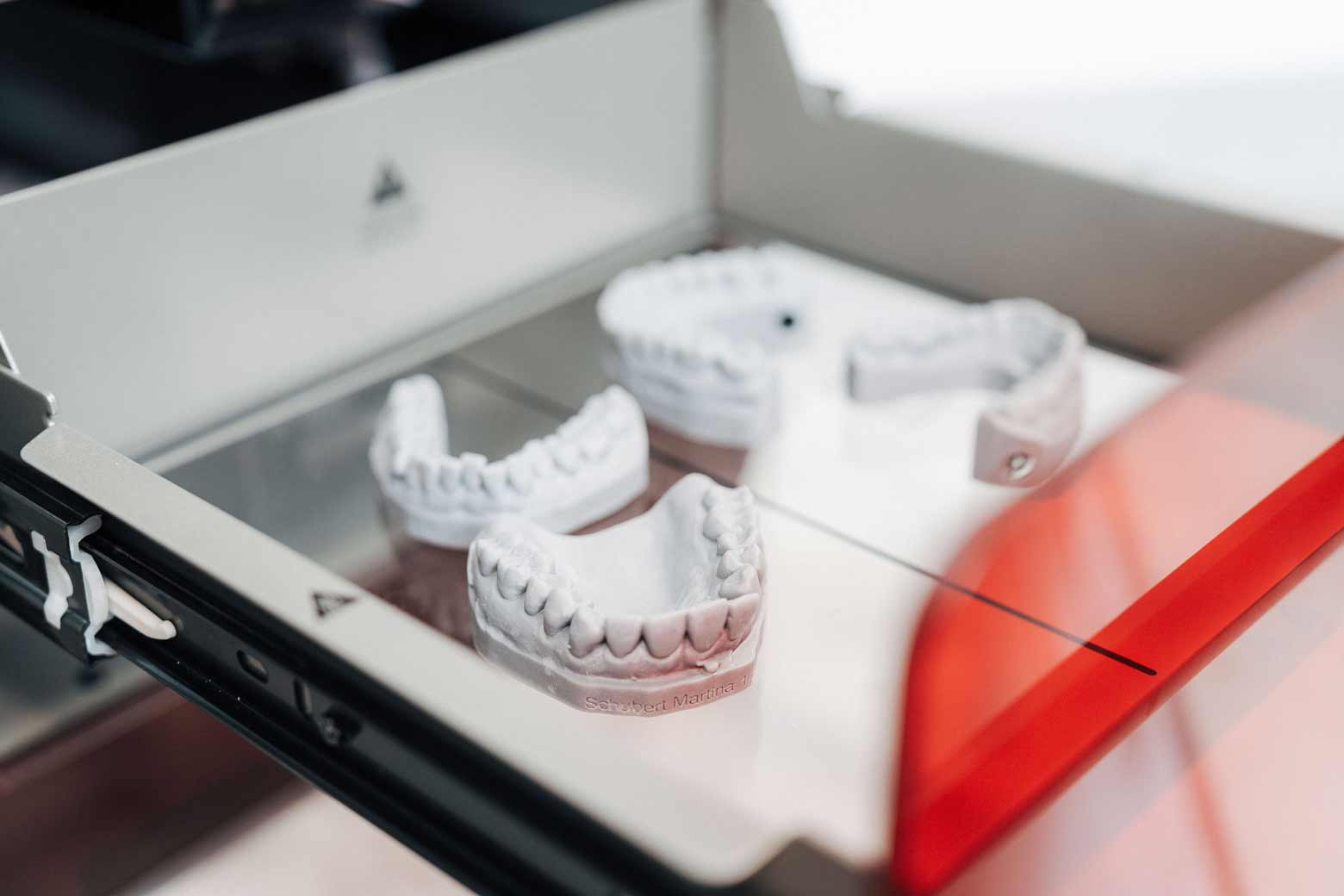 Verschiedene Abdruckmodelle von Gebissen zur Planung von metallfreiem Zahnersatz im Dentallabor von NOVA-Z in München