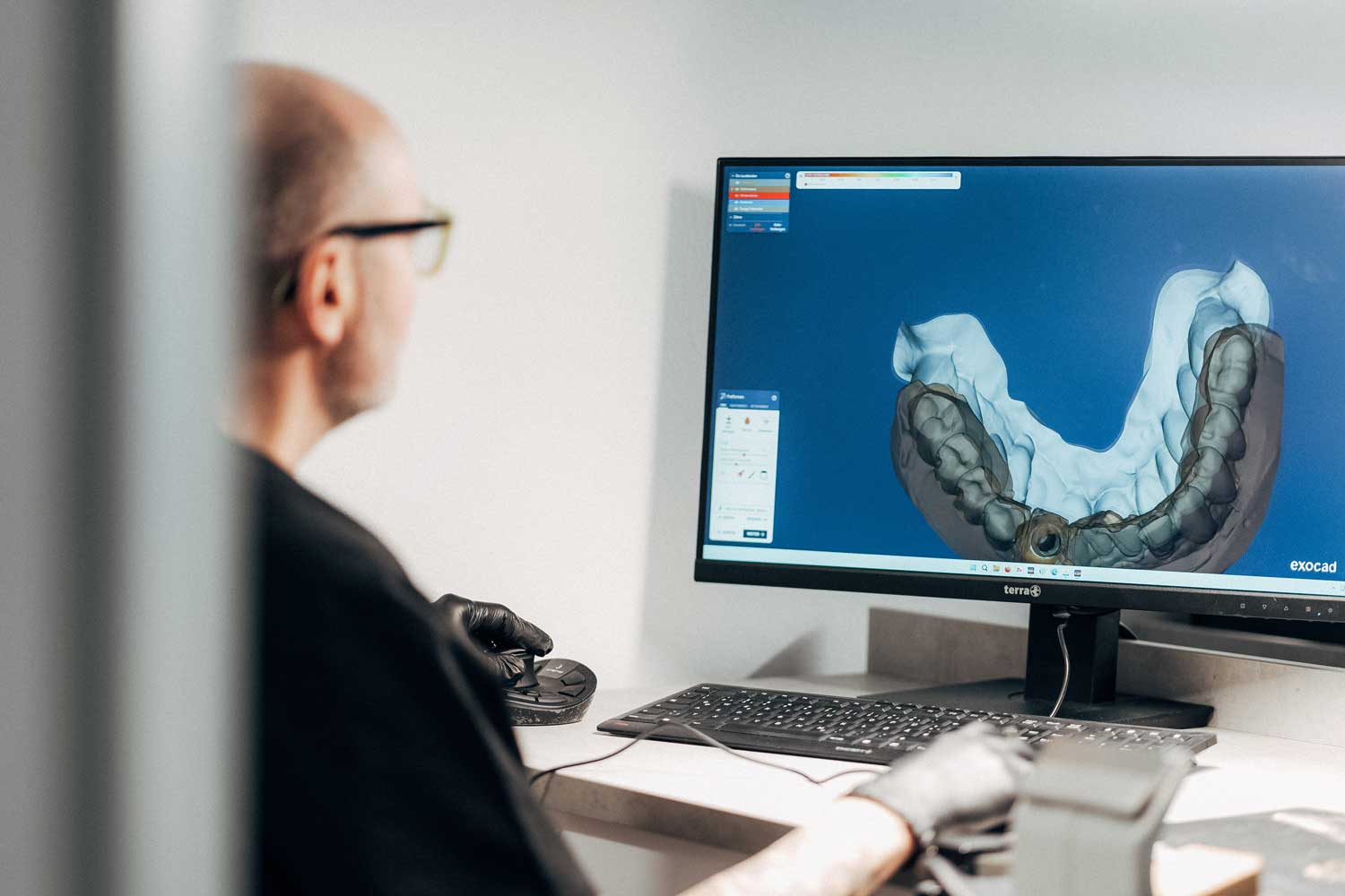 Ein Zahntechniker von NOVA-Z arbeitet an einem Bildschirm an einer implantatgetragenen Zahnersatzlösung