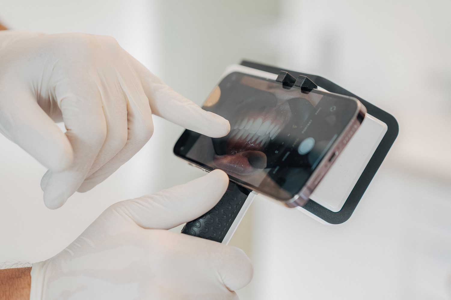 Detailaufnahme von einem Handy in einer Halterung, auf dem in Echtzeit ein Gebiss zu sehen ist. Er zeigt mit dem Finger auf einen Zahn.