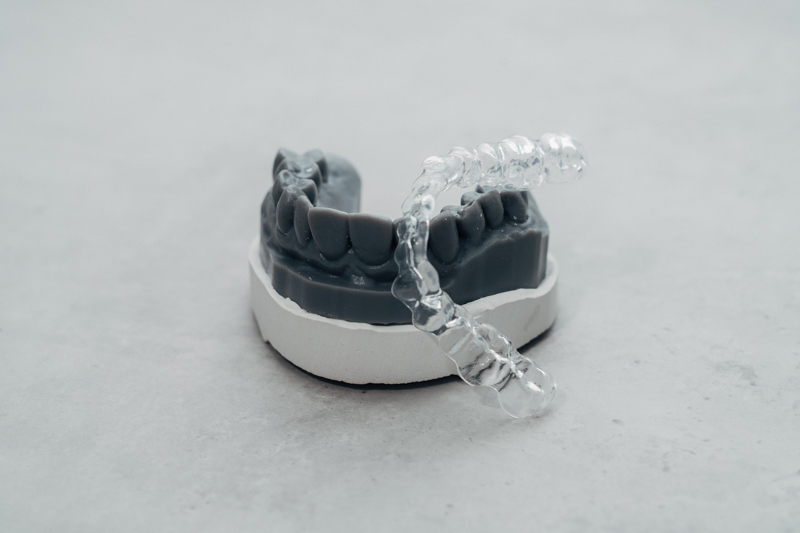 Detailbild einer Aufbisschiene zur Behandlung von CMD und Bruxismus